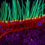 Winner of Nikon microscopy photo contest faces criticism over AI usage
